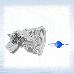 💥2025 NEW DESIGN-👂The World's First Fluid Inflatable Earplug